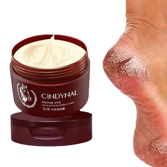 Crème Réparatrice Anti-Crevasses au Huile de Cheval – Talons & Mains Doux dès 7 Jours
